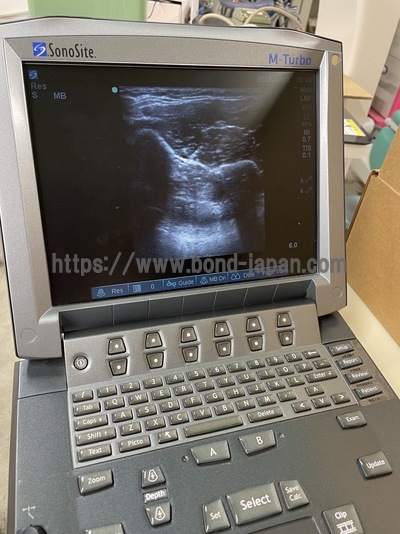 超音波診断装置/カラードプラ&nbsp;|&nbsp;株式会社富士フイルムソノサイト&nbsp;|&nbsp;M-Turboの写真