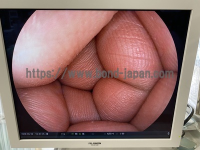 Gastroscope&nbsp;|&nbsp;FUJIFILM&nbsp;|&nbsp;EG-590WR