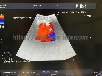 Color Doppler&nbsp;|&nbsp;HITACHI&nbsp;|&nbsp;F37