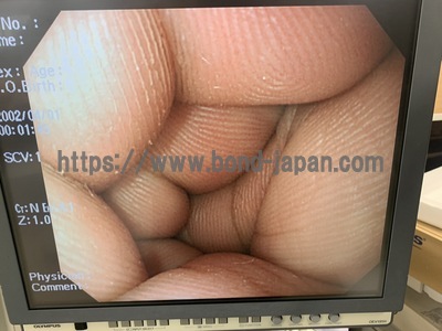 Video Gastroscope&nbsp;|&nbsp;OLYMPUS&nbsp;|&nbsp;GIF-PQ260