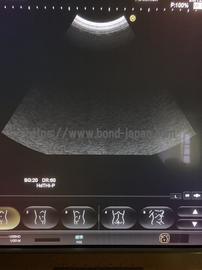 Color Doppler&nbsp;|&nbsp;HITACHI&nbsp;|&nbsp;Hi Vision Preirus