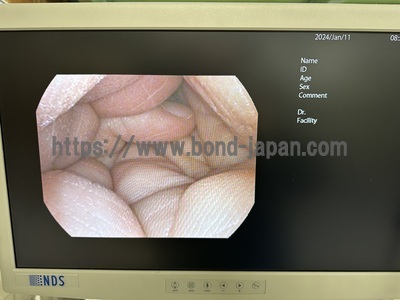 耳鼻科用ファイバースコープ&nbsp;|&nbsp;ペンタックス株式会社　医用機器事業部　国内営業部&nbsp;|&nbsp;FNL-7RP3の写真