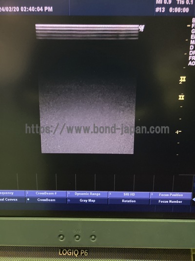 Color Doppler&nbsp;|&nbsp;GE&nbsp;|&nbsp;LOGIQ P6