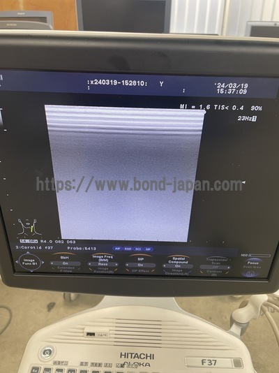 Color Doppler&nbsp;|&nbsp;HITACHI&nbsp;|&nbsp;F37