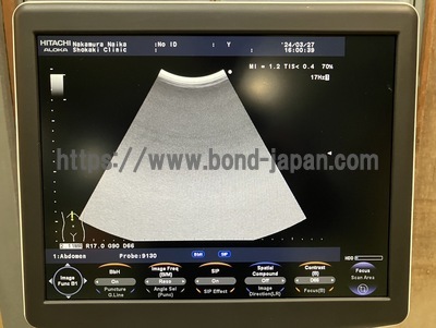 Color Doppler&nbsp;|&nbsp;HITACHI&nbsp;|&nbsp;F37