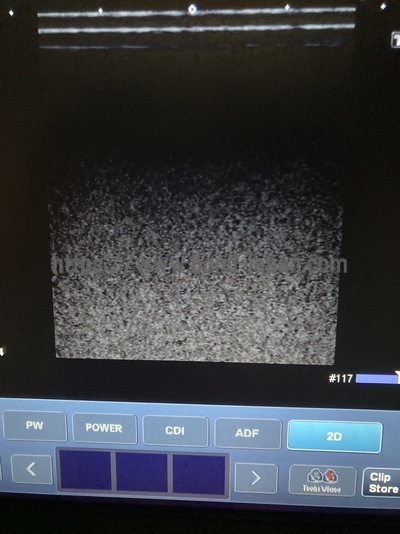 Color Doppler&nbsp;|&nbsp;CANON&nbsp;|&nbsp;Viamo SSA-640A