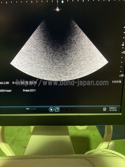 Ultrasound System&nbsp;|&nbsp;HITACHI&nbsp;|&nbsp;ARIETTA 60
