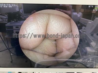 Video Gastroscope&nbsp;|&nbsp;FUJIFILM&nbsp;|&nbsp;EG-530N