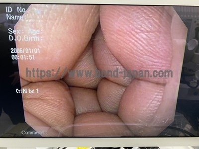 Video Gastroscope&nbsp;|&nbsp;OLYMPUS&nbsp;|&nbsp;GIF-Q150X