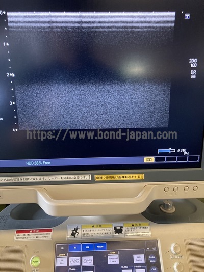 Color Doppler&nbsp;|&nbsp;CANON&nbsp;|&nbsp;SSA-660A Xario