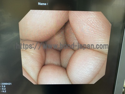 Video Gastroscope&nbsp;|&nbsp;OLYMPUS&nbsp;|&nbsp;GIF-Q260