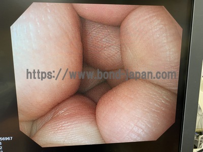 Video Gastroscope&nbsp;|&nbsp;OLYMPUS&nbsp;|&nbsp;GIF-Q260