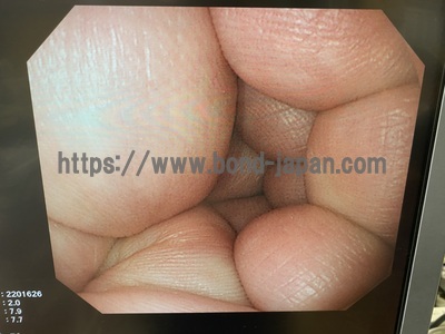 Video Gastroscope&nbsp;|&nbsp;OLYMPUS&nbsp;|&nbsp;GIF-PQ260