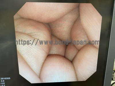 Video Gastroscope&nbsp;|&nbsp;OLYMPUS&nbsp;|&nbsp;GIF-N260