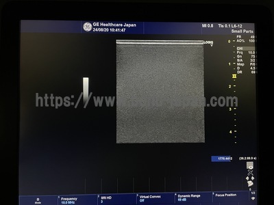 Color Doppler&nbsp;|&nbsp;GE&nbsp;|&nbsp;LOGIQ V5 Expert