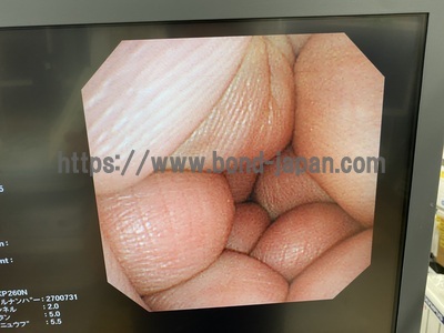 Video Gastroscope&nbsp;|&nbsp;OLYMPUS&nbsp;|&nbsp;GIF-XP260N