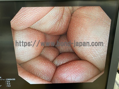 &nbsp;|&nbsp;OLYMPUS&nbsp;|&nbsp;PCF-PQ260I