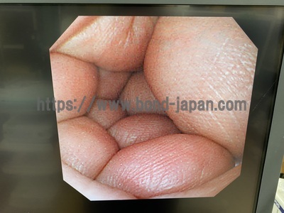 Video Gastroscope&nbsp;|&nbsp;OLYMPUS&nbsp;|&nbsp;GIF-XQ240