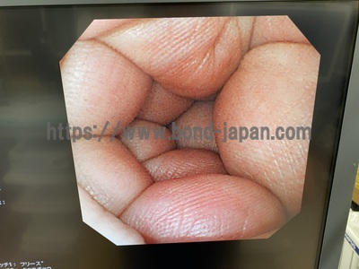 Video Gastroscope&nbsp;|&nbsp;OLYMPUS&nbsp;|&nbsp;GIF-XQ240