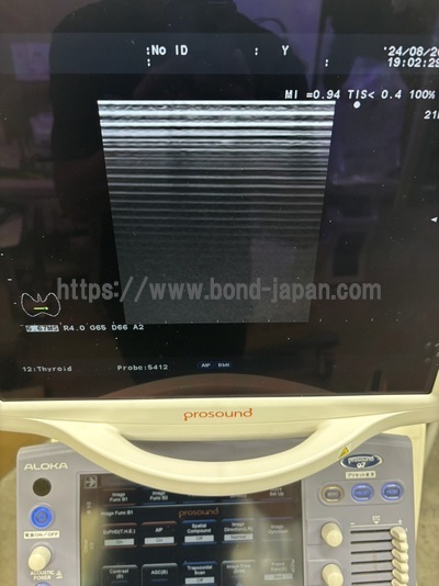 Color Doppler&nbsp;|&nbsp;HITACHI&nbsp;|&nbsp;Alpha 7