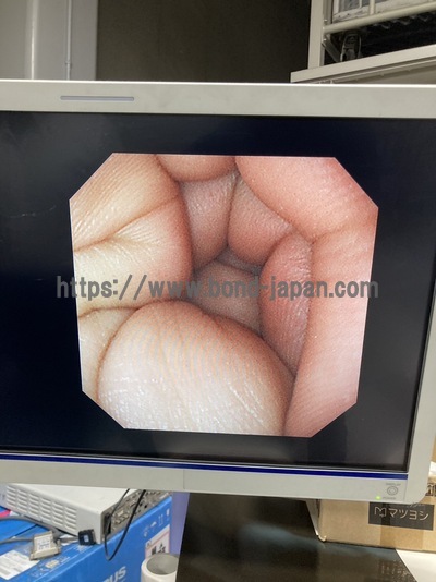 Endoscopy System&nbsp;|&nbsp;OLYMPUS&nbsp;|&nbsp;LUCERA ELITE CV-290