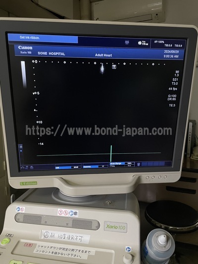 &nbsp;|&nbsp;CANON&nbsp;|&nbsp;TUS-X100S  Xario 100S