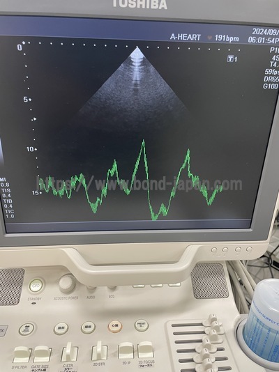 Color Doppler&nbsp;|&nbsp;CANON&nbsp;|&nbsp;SSA-590A Nemio MX