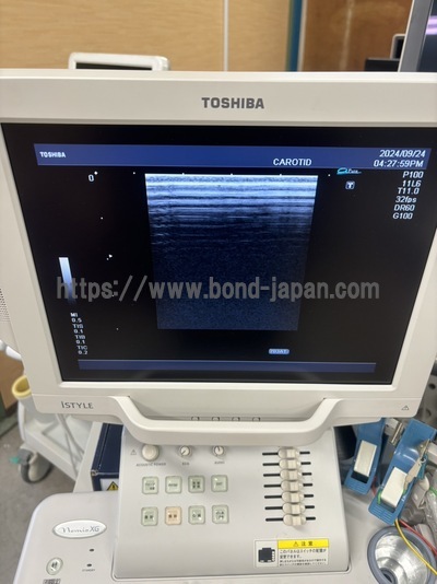 Color Doppler&nbsp;|&nbsp;CANON&nbsp;|&nbsp;SSA-580A Nemio XG