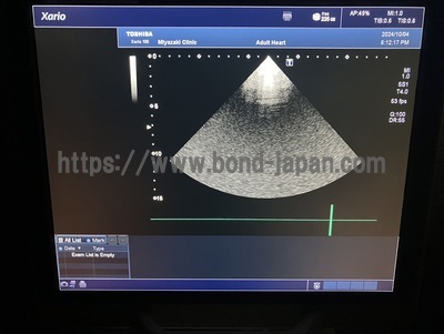 Color Doppler&nbsp;|&nbsp;CANON&nbsp;|&nbsp;TUS-X100 Xario 100