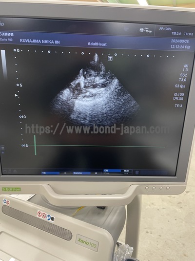 &nbsp;|&nbsp;CANON&nbsp;|&nbsp;TUS-X100S  Xario 100S