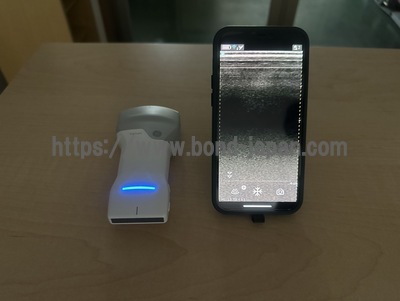 汎用超音波画像診断装置&nbsp;|&nbsp;GEヘルスケア・ジャパン株式会社&nbsp;|&nbsp;Vscan Air CLの写真