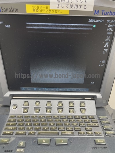 Color Doppler&nbsp;|&nbsp;SonoSite&nbsp;|&nbsp;M-Turbo