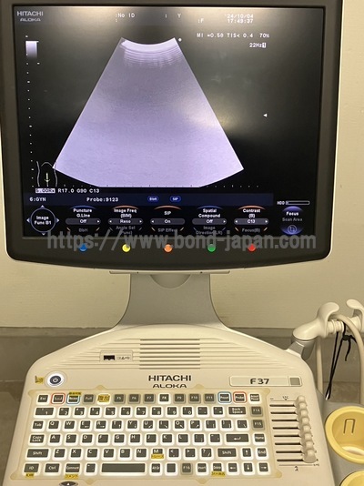 Color Doppler&nbsp;|&nbsp;HITACHI&nbsp;|&nbsp;F37
