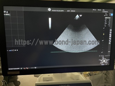 Ultrasound&nbsp;|&nbsp;GE&nbsp;|&nbsp;LOGIQ P9
