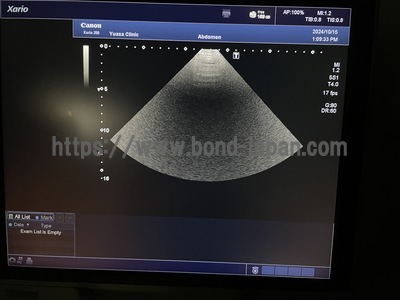 Color Doppler&nbsp;|&nbsp;CANON&nbsp;|&nbsp;Xario 200