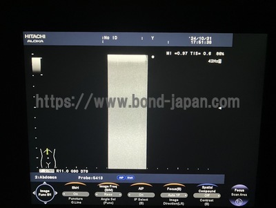 Color Doppler&nbsp;|&nbsp;HITACHI&nbsp;|&nbsp;F37