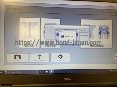 X線骨密度測定装置&nbsp;|&nbsp;富士フィルムヘルスケア株式会社&nbsp;|&nbsp;ALPHYS LFの写真