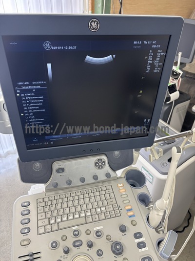 Color Doppler&nbsp;|&nbsp;GE&nbsp;|&nbsp;LOGIQ P6