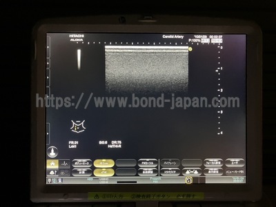Ultrasound&nbsp;|&nbsp;HITACHI&nbsp;|&nbsp;Noblus