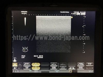 Ultrasound&nbsp;|&nbsp;HITACHI&nbsp;|&nbsp;Noblus