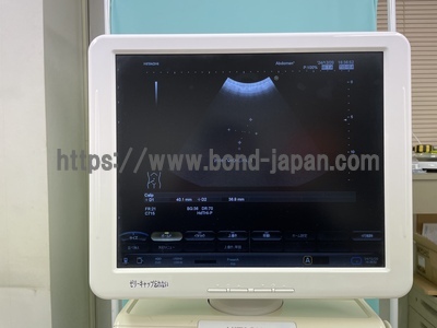Color Doppler&nbsp;|&nbsp;HITACHI&nbsp;|&nbsp;Hi Vision Avius