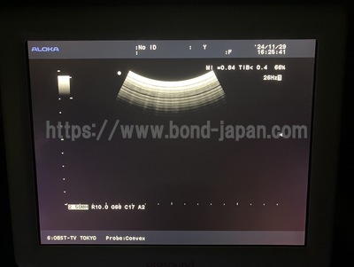 Color Doppler&nbsp;|&nbsp;HITACHI&nbsp;|&nbsp;Prosound α6