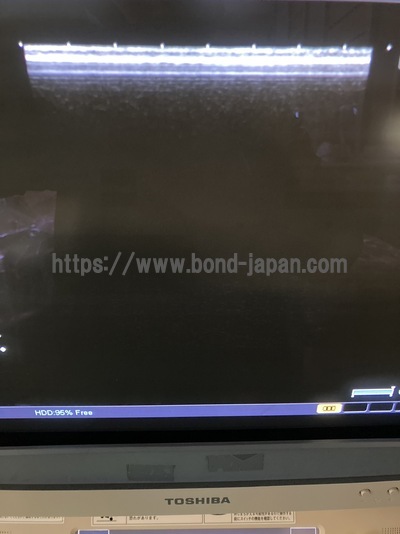 Color Doppler&nbsp;|&nbsp;CANON&nbsp;|&nbsp;SSA-660A Xario