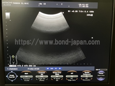 Color Doppler&nbsp;|&nbsp;HITACHI&nbsp;|&nbsp;F37