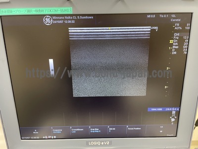 Color Doppler&nbsp;|&nbsp;GE&nbsp;|&nbsp;LOGIQ e V2