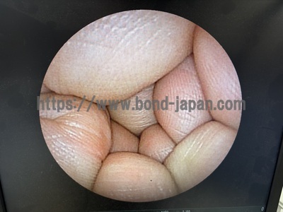 &nbsp;|&nbsp;FUJIFILM&nbsp;|&nbsp;Advancia (VP-4450,XL-4450)