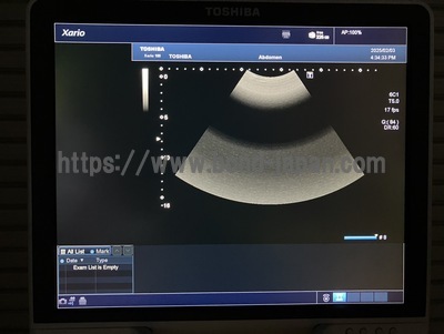 Color Doppler&nbsp;|&nbsp;CANON&nbsp;|&nbsp;TUS-X100 Xario 100