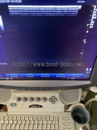 Color Doppler&nbsp;|&nbsp;GE&nbsp;|&nbsp;LOGIQ P5