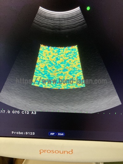 Color Doppler&nbsp;|&nbsp;HITACHI&nbsp;|&nbsp;Prosound α6