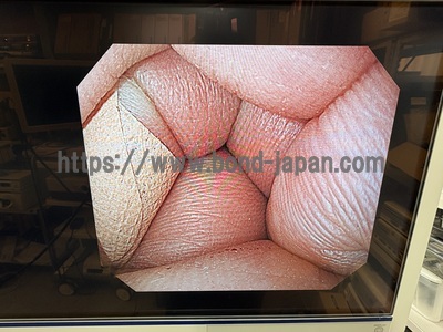 Video Gastroscope&nbsp;|&nbsp;OLYMPUS&nbsp;|&nbsp;GIF-H290